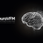 Meet NeuroVFM: A New Neuroimaging Foundation Model Trained With Vol-JEPA on Uncurated Clinical MRI and CT Volumes