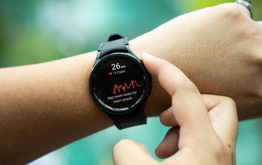 Samsung health AI models analyse wearable biosignal data